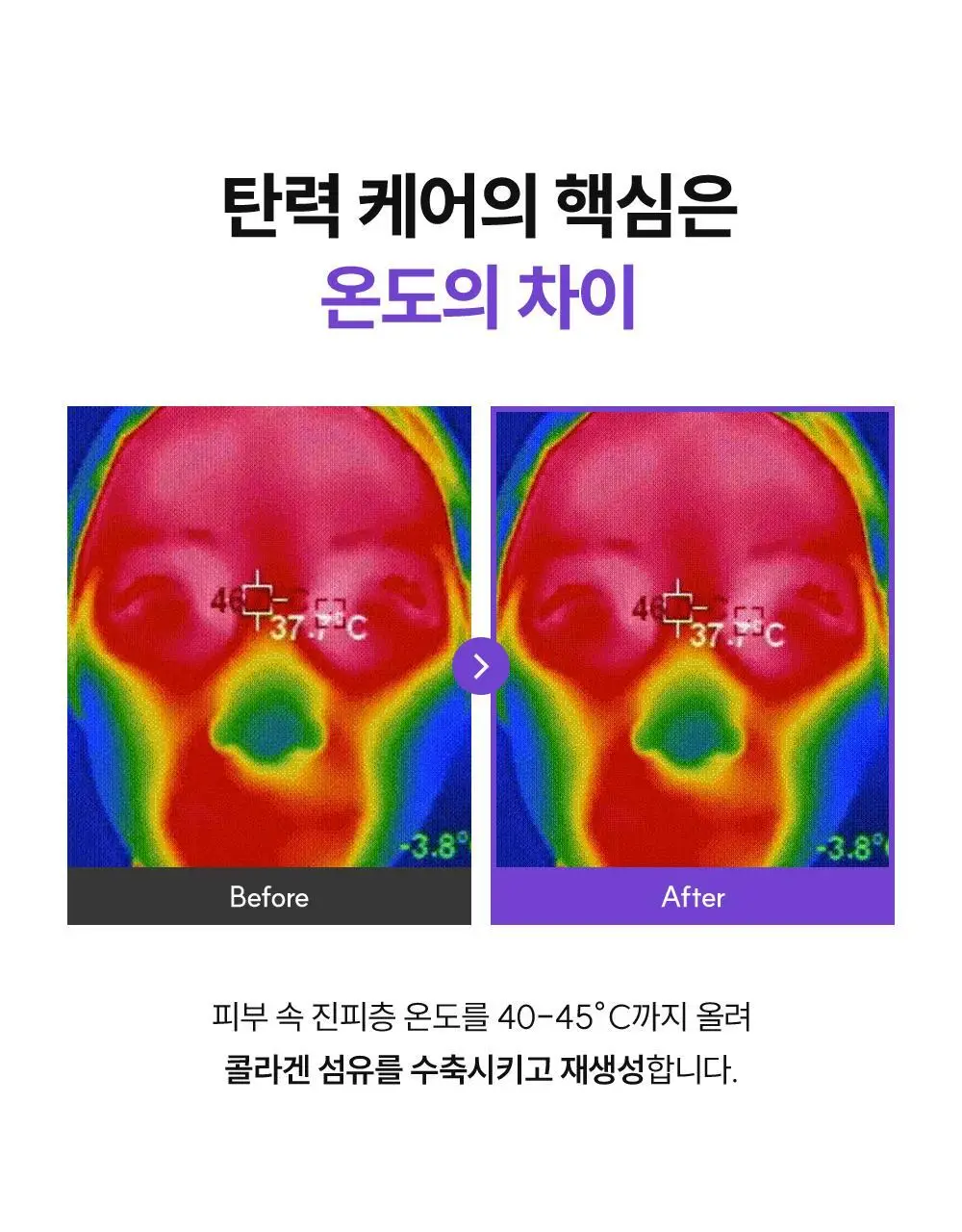 [장나라 PICK] EOA 6.78Mhz 풀써마 상세페이지 19